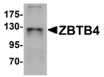ZBTB4 Antibody in Western Blot (WB)