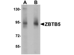 ZBTB5 Antibody in Western Blot (WB)