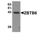 ZBTB6 Antibody in Western Blot (WB)