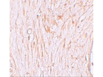 ZBTB7A Antibody in Immunohistochemistry (Paraffin) (IHC (P))