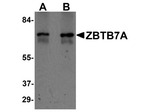 ZBTB7A Antibody in Western Blot (WB)