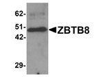ZBTB8 Antibody in Western Blot (WB)