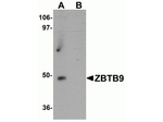 ZBTB9 Antibody in Western Blot (WB)