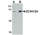ZC3H12A Polyclonal Antibody