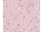 ZC3H12B Polyclonal Antibody