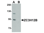 ZC3H12B Antibody in Western Blot (WB)