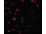 ZC3HAV1 Antibody in Immunocytochemistry (ICC/IF)