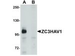 ZC3HAV1 Antibody in Western Blot (WB)