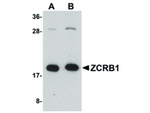 ZCRB1 Polyclonal Antibody