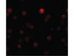 ZEB1 Antibody in Immunocytochemistry (ICC/IF)