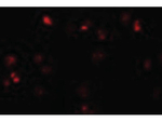 ZEB2 Antibody in Immunocytochemistry (ICC/IF)