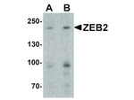 ZEB2 Antibody in Western Blot (WB)