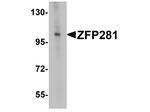 ZFP281 Antibody in Western Blot (WB)
