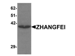 ZHANGFEI Antibody in Western Blot (WB)
