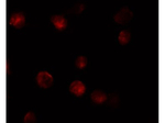 ZIMP10 Antibody in Immunocytochemistry (ICC/IF)