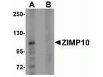 ZIMP10 Antibody in Western Blot (WB)