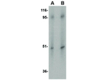 ZIP10 Antibody in Western Blot (WB)