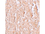 ZIP10 Antibody in Immunohistochemistry (Paraffin) (IHC (P))