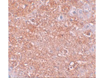 ZIP12 Antibody in Immunohistochemistry (Paraffin) (IHC (P))