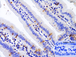 ZIP14 Antibody in Immunohistochemistry (Paraffin) (IHC (P))