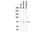 ZIP14 Antibody in Western Blot (WB)
