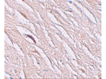 ZIP2 Antibody in Immunohistochemistry (Paraffin) (IHC (P))