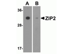 ZIP2 Antibody in Western Blot (WB)