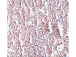 ZIP5 Antibody in Immunohistochemistry (Paraffin) (IHC (P))