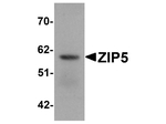 ZIP5 Antibody in Western Blot (WB)