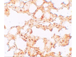 ZIP6 Antibody in Immunohistochemistry (Paraffin) (IHC (P))
