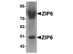 ZIP6 Antibody in Western Blot (WB)