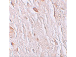 ZIP7 Antibody in Immunohistochemistry (Paraffin) (IHC (P))