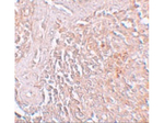 ZIP8 Antibody in Immunohistochemistry (Paraffin) (IHC (P))