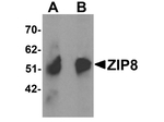 ZIP8 Antibody in Western Blot (WB)
