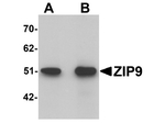 ZIP9 Antibody in Western Blot (WB)