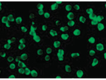 ZIPK Antibody in Immunocytochemistry (ICC/IF)