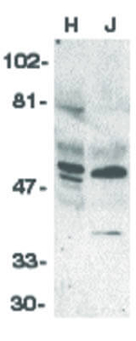 ZIPK Antibody in Western Blot (WB)