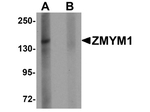 ZMYM1 Antibody in Western Blot (WB)