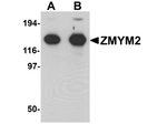 ZMYM2 Antibody in Western Blot (WB)