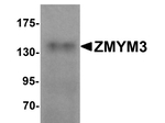 ZMYM3 Antibody in Western Blot (WB)