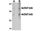 ZNF346 (CT) Antibody in Western Blot (WB)