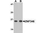 ZNF346 Polyclonal Antibody