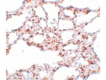 ZSCAN4 Antibody in Immunohistochemistry (Paraffin) (IHC (P))