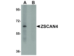 ZSCAN4 Antibody in Western Blot (WB)