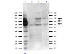 Integrin beta 3 Antibody in Western Blot (WB)
