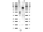 ACSS2 Polyclonal Antibody
