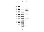 Methyl-Retinoblastoma (Lys860) Antibody in Western Blot (WB)