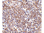 LIPE Antibody in Immunohistochemistry (Paraffin) (IHC (P))