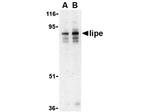 LIPE Antibody in Western Blot (WB)
