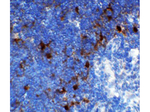 NALP3 Antibody in Immunohistochemistry (Paraffin) (IHC (P))
